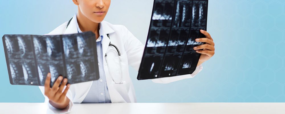 healthcare, medicine, people and radiology concept - african american female doctor looking at x-rays over blue background